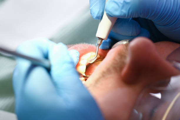 Best Emergency Treatment for Toothache in Conyers, GA