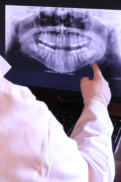 Best Emergency Tooth Extraction in Conyers, GA