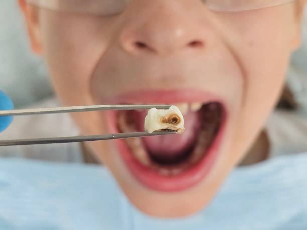 Best Emergency Treatment for Toothache in Conyers, GA
